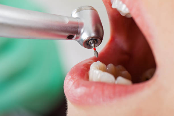 Best Emergency Gum Treatment in Gordon, GA
